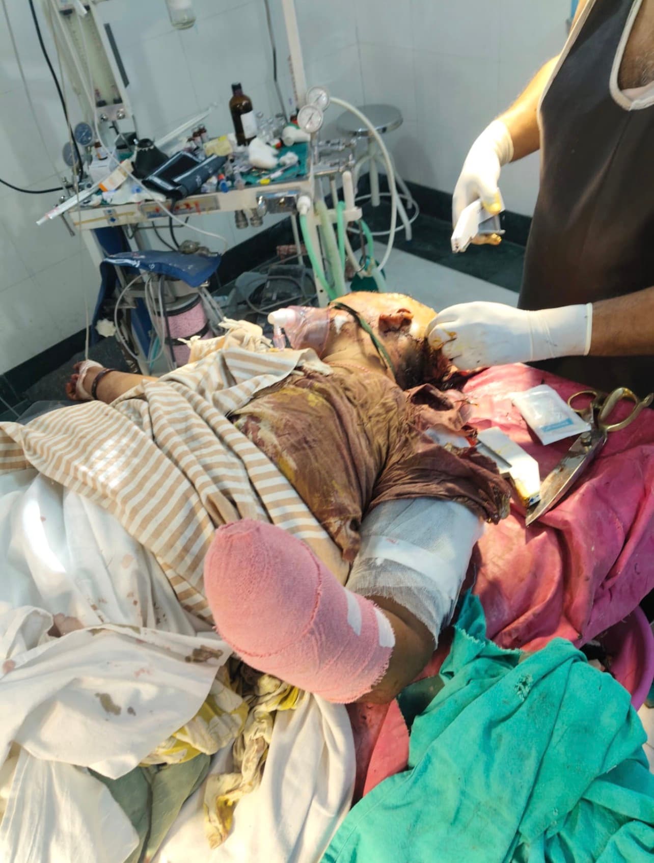 Portrait of Juhi, a survivor of a brutal dowry attack, recovering from severe injuries while seeking urgent medical and rehabilitation support.